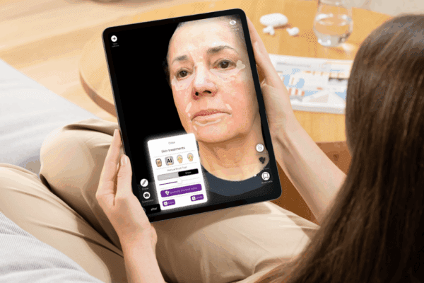 3d-simulering av ansiktslyft